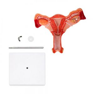 MODELO ÚTERO personalizada